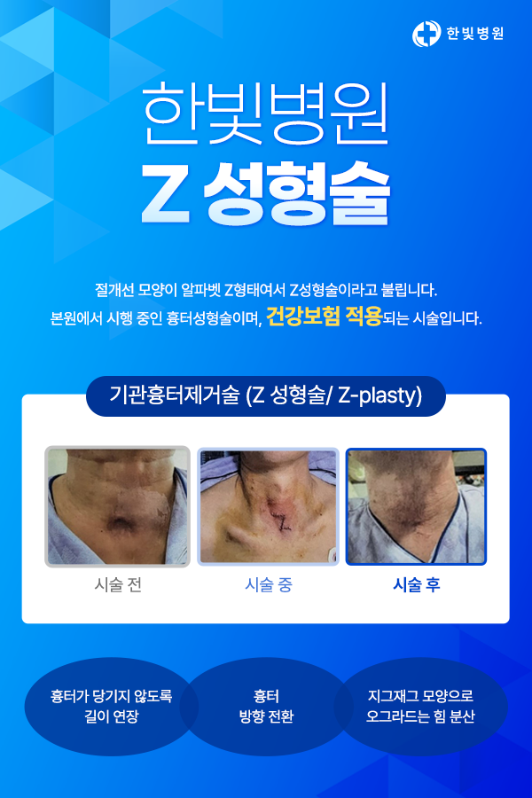 팝업3